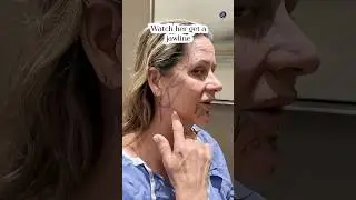 Natural Results| Face and Neck Lift 2 Months Post-Op| Before and After