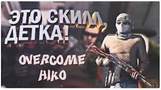 Лучшие мометы PRO игрока 