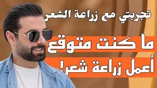 مقابلة مع المخرج طارق زياد عائشه | تجربتي مع زراعة الشعر