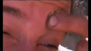 Born Survivor - Bee Sting
