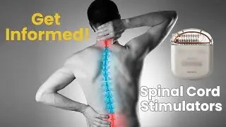 Is a Spinal Cord Stimulator Right for You?