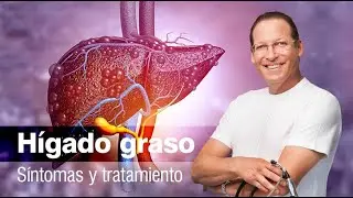 📌 Hígado graso o esteatosis hepática - Síntomas y tratamiento 👨🏻‍⚕️🩺