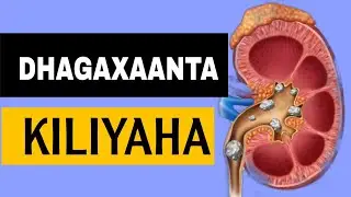 DHAGAXAANTA KILIYAHA |MAXAA SABABA| WAA IMISA NUUC | @xogocaafimaad