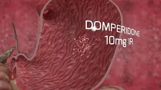 Medical Animation | Rabium DSR 360 | 3D Animation | Stereo 360 | VR