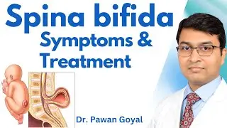 Spina bifida Symptoms & Treatment | Dr. Pawan Goyal