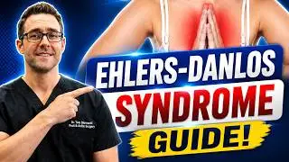 Ehlers Danlos Syndrome [Hypermobility, Symptoms, Diagnosis & Test]