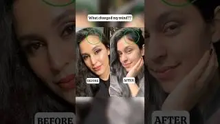 Why I stopped using Rosemary Oil? 