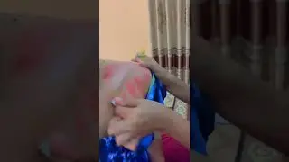cewek kerokan dada