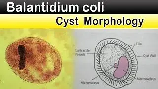 Balantedium Coli Cyst Morphology