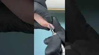 Наращивание на верхние формы