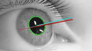 Can open-source eye tracking be THIS accurate?