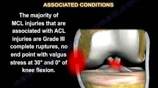 Medial Collateral Ligament injury , MCL Injuries - Everything You Need To Know - Dr. Nabil Ebraheim