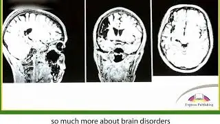 Action 11. Module 3. Brain Gain - The Future of Brain Technology