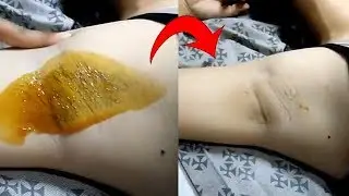 In Just 3 Minutes - Remove Armpit Hair Permanently (Before & After) Remove Unwanted Hair