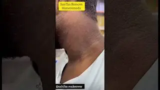 Tanning Remove/Neck Cleaning Hometips l#tanremove#skincare #viralvedio #ytshorts #beautytips#shorts