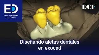 Diseñando aletas dentales