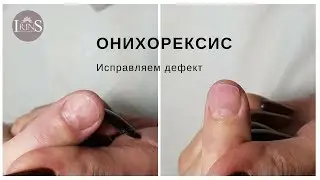 Онихорексис. Исправляем дефект