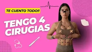 TENGO 4 CIRUGÍAS, ¡TE CUENTO TODO!