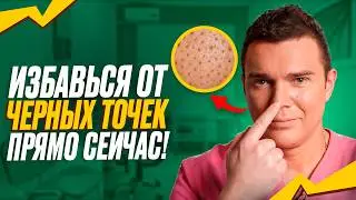 Blackheads on your nose? Here's how to properly treat sebaceous threads!