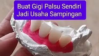 Usaha Pembuatan Gigi Palsu