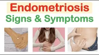 Endometriosis Signs & Symptoms (& Why They Occur)