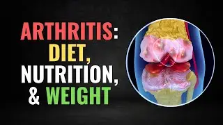 Unrevealed Connection Between Your Diet and Knee Arthritis