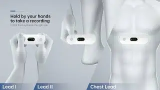 ER2 Easy ECG