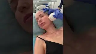 ELOS - Ліфтинг. Медичний центр Оксфорд Медікал Хмельницький