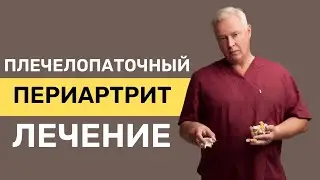 Боль в Плече. Плечелопаточный Периартрит. Симтомы и лечение
