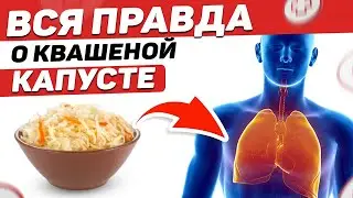 🍽 👍 5 Причин есть КВАШЕНУЮ КАПУСТУ каждый день / Чем полезна КИСЛАЯ КАПУСТА?