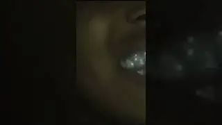Xxxtentacion showing his grills