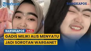 Girl with Converged Eyebrows and a Thick Mustache Becomes Netizens' Spotlight