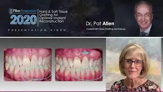 Pat Allen Current Soft Tissue Grafting Techniques