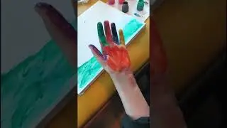 Periferik Sinir Yaralanması