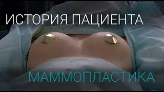 Теперь моя грудь лучше чем у сестры