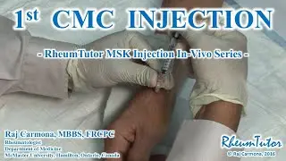1st CMC Injection - In Vivo Series