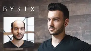 Complément capillaire indétectable | Hair transformation
