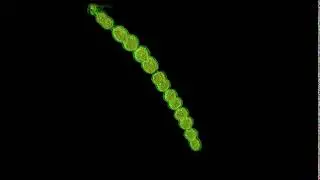 Cyanobacteria filament