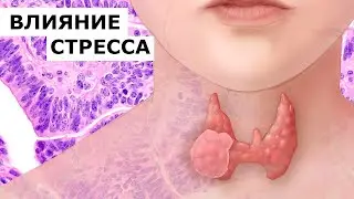 Стресс и щитовидная железа. Продукция NSP