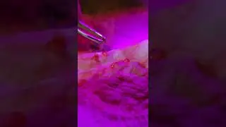Raspberries