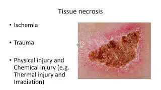Inflammation 1