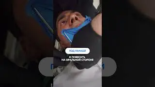 Как зафиксировать слюноотсос в коффердаме БЕЗ АССИСТЕНТА?  #dent #robberdam #dentist