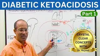 Diabetic Ketoacidosis | Symptoms | Causes | Diagnosis | Part 1 👨‍⚕️