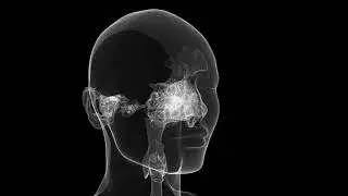 Post Processing  For  CT Studies (Medical imaging)