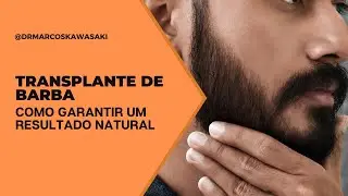 TRANSPLANTE DE BARBA | Como garantir um resultado natural