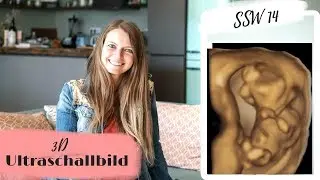 14. Schwangerschaftswoche | Nackenfaltenmessung / Ersttrimesterscreening | Lilies Diary