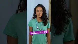 CELLULITE 🍊 Das ist die URSACHE | DR. FLOJO #shorts #medizin #cellulite #haut