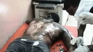 Haitiano hecha aceite caliente a paisano por deuda