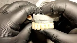 PROMO: Full Arch Zirconia Restorations On Implants Reinforced with Titanium Bars - WEBINAR