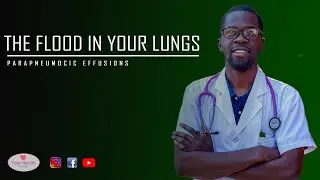 The Flood in Your Lungs | Parapneumonic Effusions - What are they ?